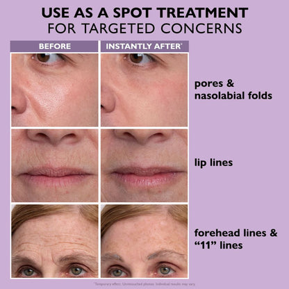 Korynexial Instant Face Provisional Eye Tightener Easy- Wear Tech