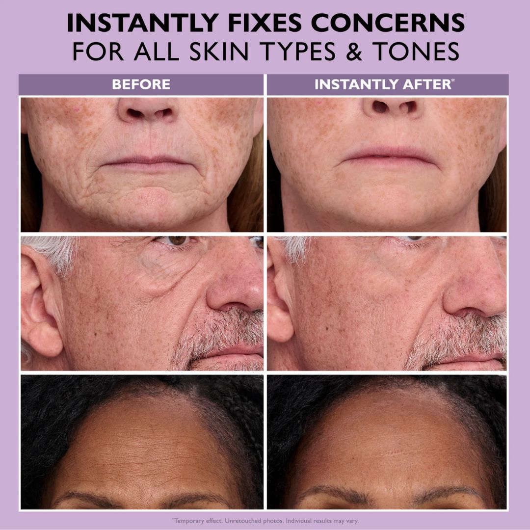Korynexial Instant Face Provisional Eye Tightener Easy- Wear Tech