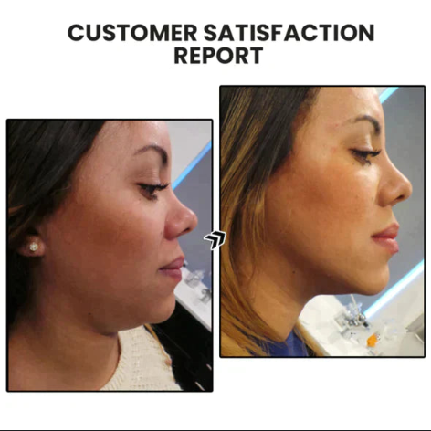 Miniyou Lymphatic drainage earrings（🔥LAST DAY SALE-50% OFF)