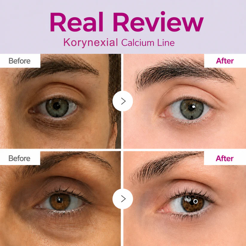 🔥LAST DAY 50% OFF|Korynexial Korean Calcium Dark Spot Eye Cream