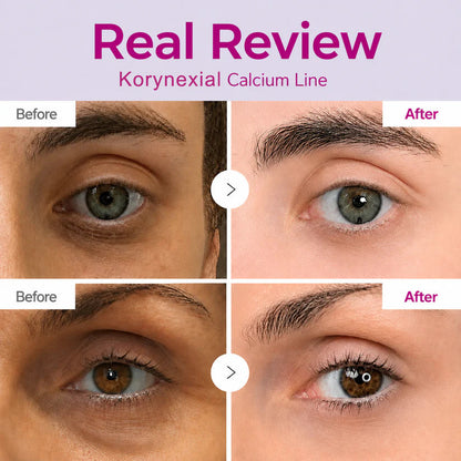 🔥LAST DAY 50% OFF|Korynexial Korean Calcium Dark Spot Eye Cream